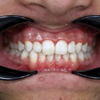 Пример работы до и после -