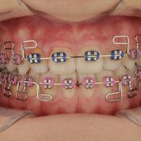 Пример работы до и после -