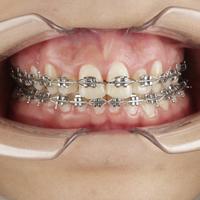 Пример работы до и после -